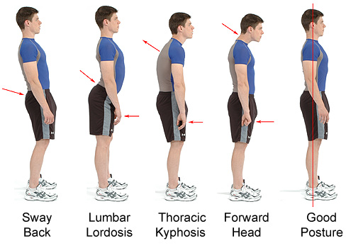 poor-posture-sequence2