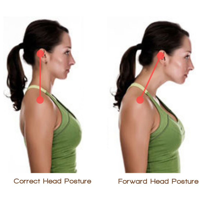 Neck tension when wearing a heavy coat - Integrative Works  Forward head  posture, Neck and shoulder exercises, Integrative