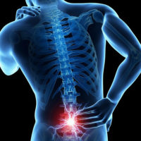mri for low back pain