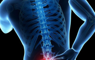 mri for low back pain
