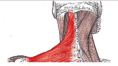 Headaches and Neck Muscles - Intro - West Suburban Pain Relief