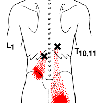 Low Back Pain - Longissimus Thoracis, Spinal Erectors