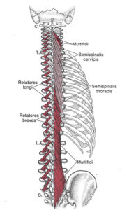 Low Back Pain - Multifidi