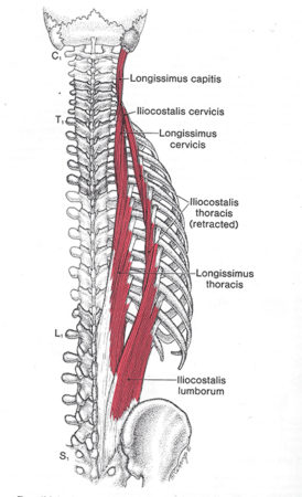 Low Back Pain - Paraspinals - West Suburban Pain Relief