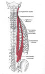 Low Back Pain - Paraspinals - West Suburban Pain Relief