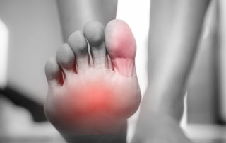 claw toes and foot pain