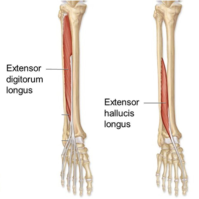 Hammer toes, foot pain? - Check out West Suburban Pain Relief!