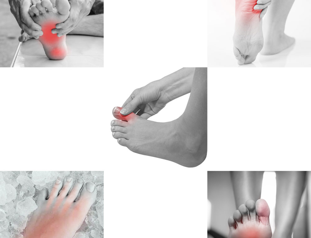 Big Toe and Ankle Pain Tibialis Anterior West Suburban Pain Relief