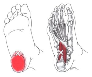 deep intrinsic muscle of the foot quadratus plantae