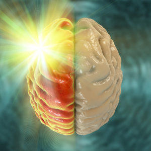 migraine headache pain myofascial therapy trigger point aura