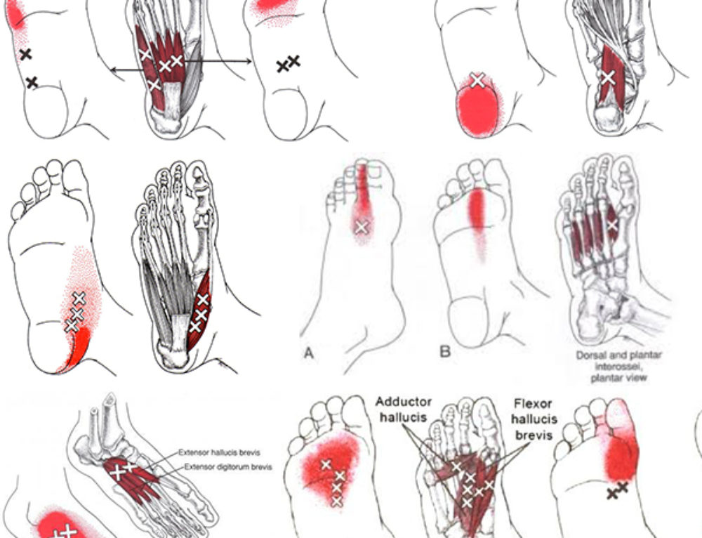 Big Toe and Ankle Pain Tibialis Anterior West Suburban Pain Relief