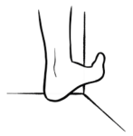 claw toes and foot pain long toe flexors stretch