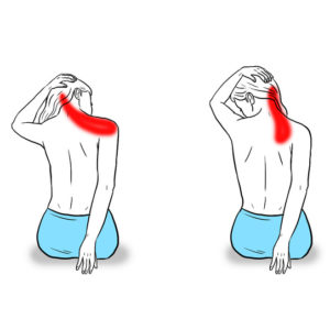 chronic tension headache - trigger point therapy stretches