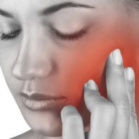 tmj headache - myofascial pain
