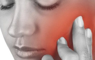 tmj headache - myofascial pain