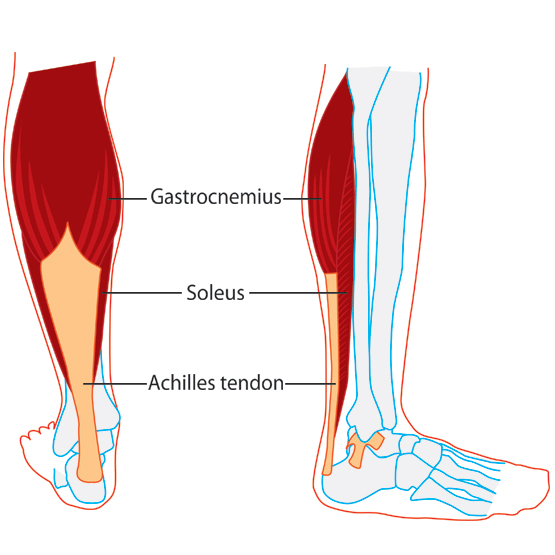lower leg pain? trigger point soleus anatomy