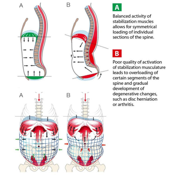 Exercises Reduce Low Back Pain - West Suburban Pain Relief