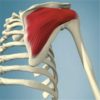 Infraspinatus Muscle - Shoulder to Hand Pain - West Suburban Pain Relief