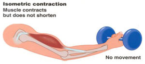 Triceps Brachii - Upper Arm/Elbow/Hand Pain - West Suburban Pain Relief