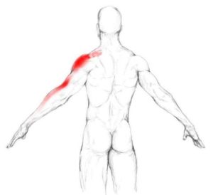 supraspinatus trigger point